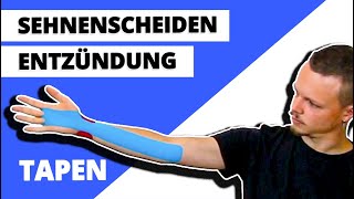 Sehnenscheidenentzündung tapen  Handgelenk tapen  Kinesiologie ANLEITUNG [upl. by Griffith544]