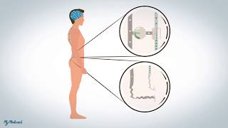 Douleurs neuropathiques et dysfonctionnelles explication [upl. by Geer]